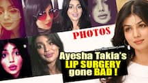 PHOTOS: Ayesha Takia's UNRECOGNIZABLE looks post LIP SURGERY will BLOW YOUR MIND!