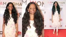 IN PICS: Acid attack survivor Laxmi Agarwal SHINES at the 'I Am Woman Awards' in Mumbai!