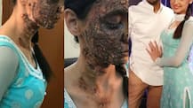 Nach Baliye 8: IN PICS- Sanaya Irani performs with 'bruises' on face to score a perfect 30 this week!