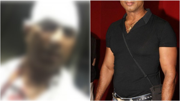 Bollywood Actor Jeetu Verma ATTACKED in Chittorgarh; right eye DAMAGED, could LOSE his eye! Bollywood Actor Jeetu Verma ATTACKED in Chittorgarh; right eye DAMAGED, could LOSE his eye!