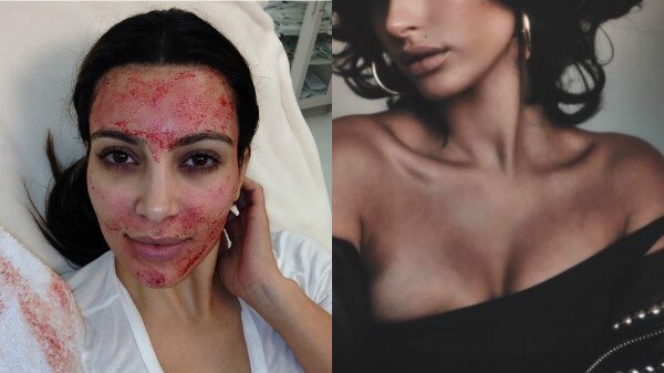 SCARY! After Kim Kardashian famous model Hailey Baldwin reveals she uses face cream made from her own BLOOD! SCARY! After Kim Kardashian famous model Hailey Baldwin reveals she uses face cream made from her own BLOOD!