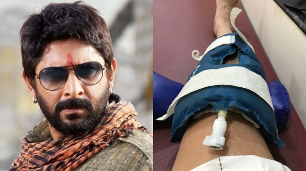 Bollywood actor Arshad Warsi suffers knee injury, advised bed rest Bollywood actor Arshad Warsi suffers knee injury, advised bed rest