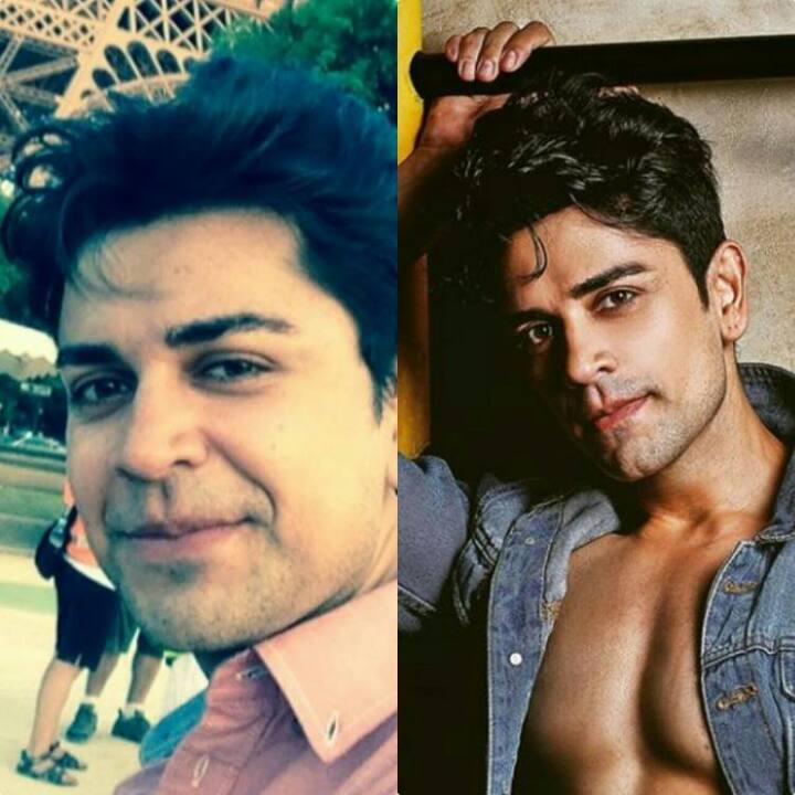 And now, the 'Beyhadh' hottie has again grabbed limelight as there now there are reports that he seems to have gone the surgical way. Speaking about the same, a source told Pinkvilla that, 