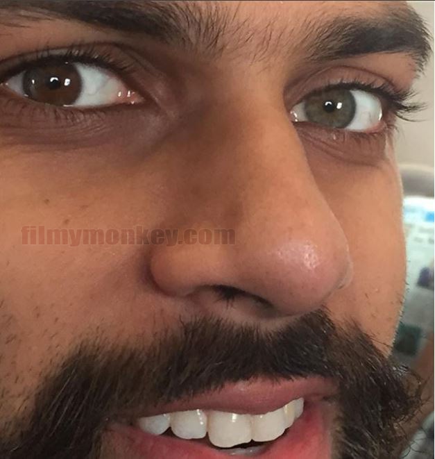 You can see how both the eyes of Siddharth actually have two different colors. Kimmey wrote with the picture - 