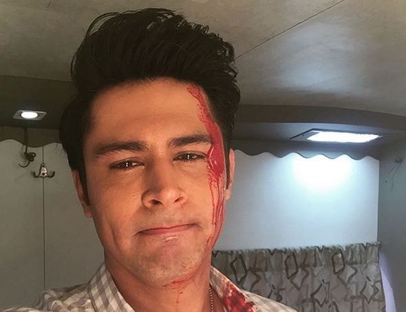 Zee TV actor Sudeep Sahir gets INJURED Zee TV actor Sudeep Sahir gets INJURED