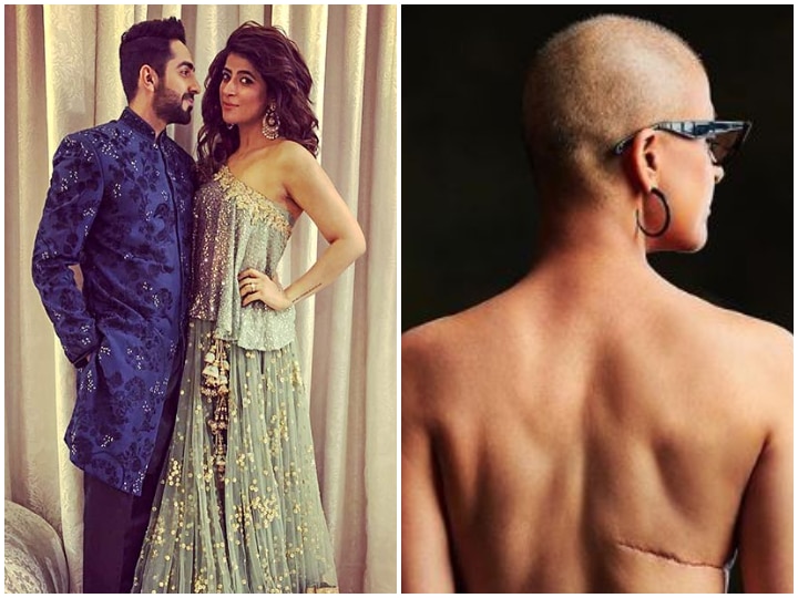 World Cancer Day 2019: Ayushmann Khuranna's wife Tahira Kashyap shows her surgery marks! PIC: Ayushmann's wife Tahira Kashyap shows her surgery marks on 'World Cancer Day'!