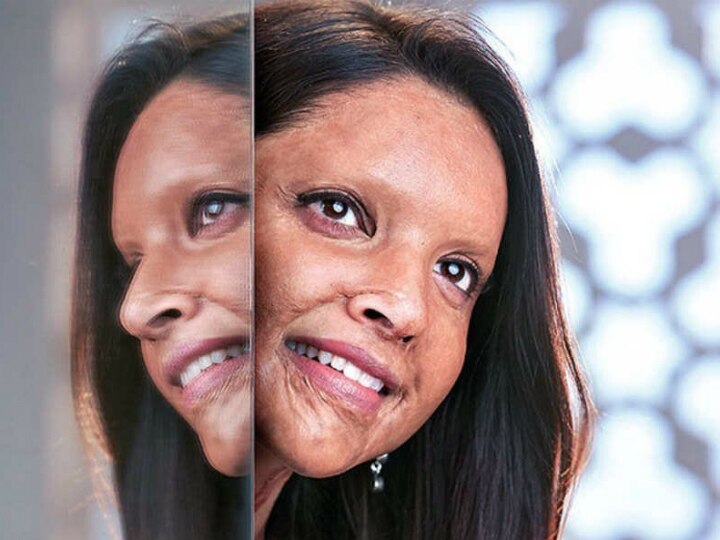 Chhapaak: Deepika Padukone's first look from acid attack survivor Laxmi Agarwal's biopic is OUT! SEE PIC! PIC: Deepika Padukone's first look as acid attack survivor from 'Chhapaak' is OUT!