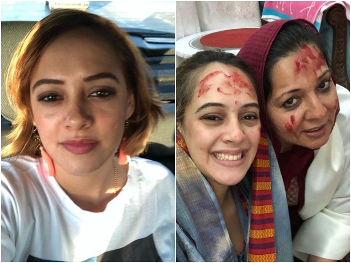 Yuvraj Singh’s wife Hazel Keech undergoes nose surgery, thanks her mother-in-law in a heartwarming note ‘Love you, Shabo’: Yuvraj Singh’s wife Hazel Keech undergoes nose surgery, thanks her mother-in-law in a heartfelt note