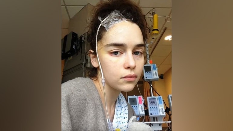 Game of Thrones star Emilia Clarke shares unseen photos from brain surgeries