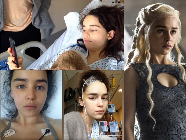 Game of Thrones star Emilia Clarke shares unseen photos from brain surgeries Game of Thrones star Emilia Clarke shares unseen photos from brain surgeries