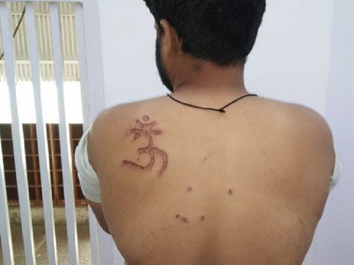 Branded with Om symbol by Tihar jail official, claims prisoner, court orders probe Branded with Om symbol by Tihar jail official, claims prisoner; court orders probe