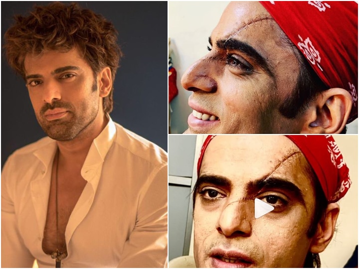 Kullfi Kumarr Bajewala- Producer Nilanjana shares Mohit Malik aka Sikandar's NEW look post his accident (SEE PICS) Kullfi Kumarr Bajewala: Producer shares Mohit Malik aka Sikandar's NEW look post his accident (SEE PICS)