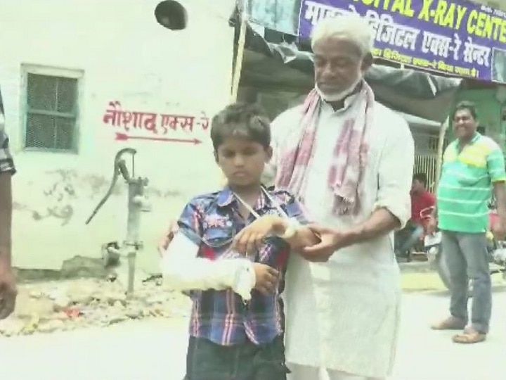 Fracture On Left Hand, But Plaster On Right! Story Of Poor Healthcare System In Bihar Fracture On Left Hand, But Plaster On Right! Story Of Poor Healthcare System In Bihar