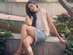 PICS: Digangana Sooryavanshi Reveals She Danced In Hippi Despite Her Severe Leg Injury