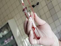 Goa May Make HIV Tests Mandatory Before Marriage Registration