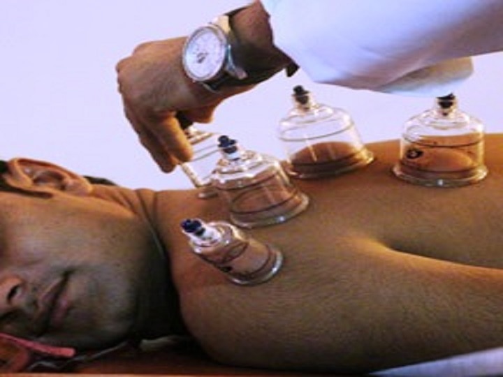 Cupping Therapy Is The In-Thing Now! Cupping Therapy Is The In-Thing Now!