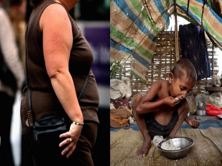 More Indians Obese But Fewer Undernourished: FAO More Indians Obese But Fewer Undernourished: FAO