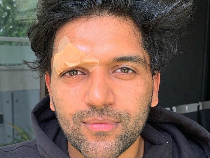 'Assaulted' Guru Randhawa returns to India with 4 stitches on forehead, A punjabi fan punched him in face at Vancouver! Guru Randhawa Returns To India With 4 Stitches On Forehead, Reveals Fan Punched Him In The Face At Vancouver Narrating The Whole Incident!