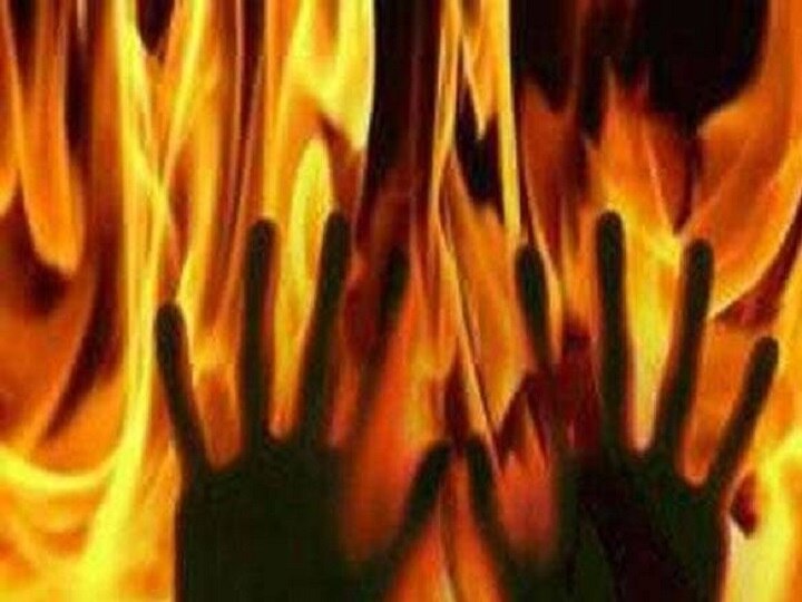 Woman In UP Set On Fire After Failed Rape Attempt Woman In UP Set On Fire After Failed Rape Attempt