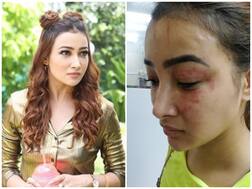 'Naamkarann' & 'Splitsvilla' Fame Nalini Negi Accuses Her Roommate Preeti Rana Of Physical Assault!