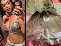 'Naagin 4' Actress Nia Sharma's Silver Lehenga Got Burnt In Diwali 2019 Party Catching Fire From A Diya, Narrates Story With The Pic!