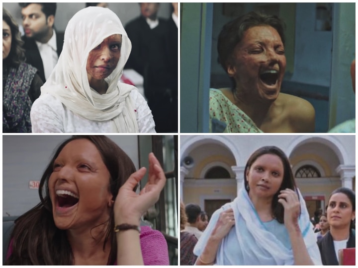 'Chhapaak' Trailer: Deepika Padukone's Portrayal Of Acid Attack Survivor 'Malti' Will Shake You Up! 'Chhapaak' Trailer: Deepika Padukone's Portrayal Of An Acid Attack Survivor Will Shake You Up!