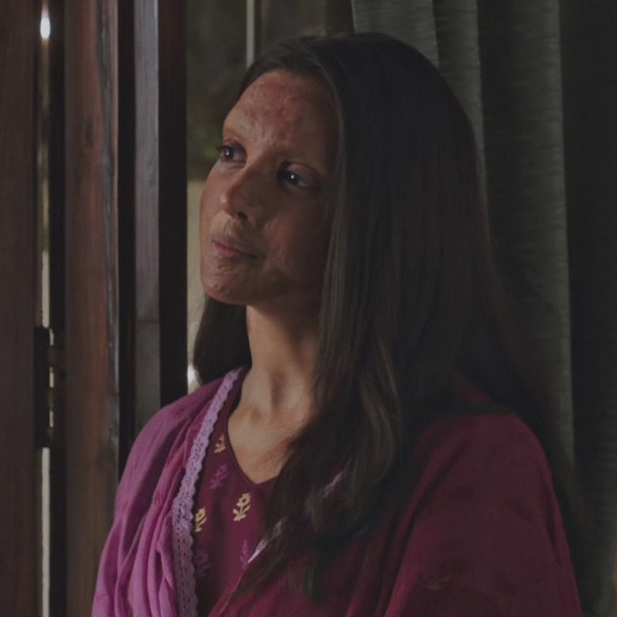 Chhapaak' Trailer: Deepika Padukone's Portrayal Of An Acid Attack Survivor Will Shake You Up!