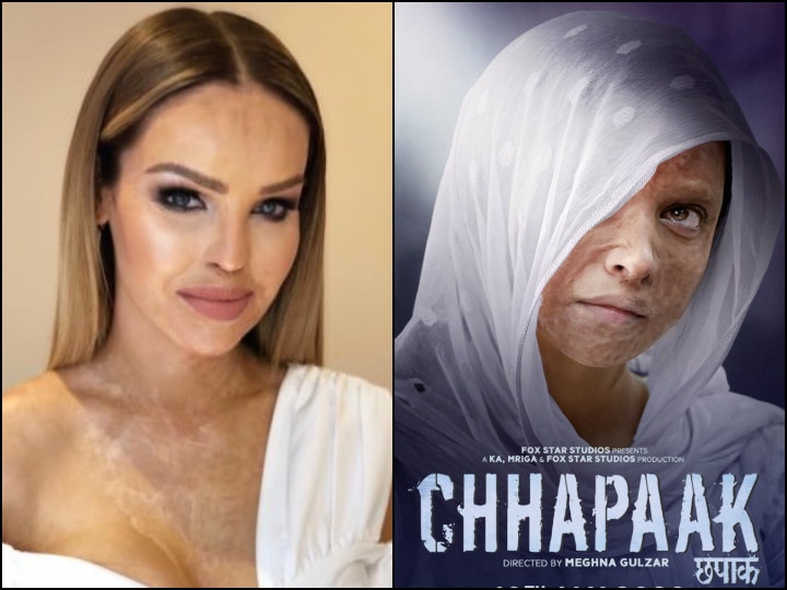 English Activist & Acid Attack Survivor Katie Piper Praises Deepika Padukone's 'Chhapaak' Trailer English Activist & Acid Attack Survivor Katie Piper Praises Deepika Padukone's 'Chhapaak' Trailer