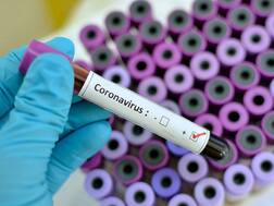 Pakistan Suspends Six Civil Servants For Taking Selfie With Coronavirus Patient