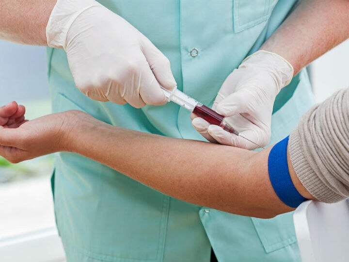 Simple Blood Test Can Help Reduce Heart Disease Deaths Simple Blood Test Can Help Reduce Heart Disease Deaths