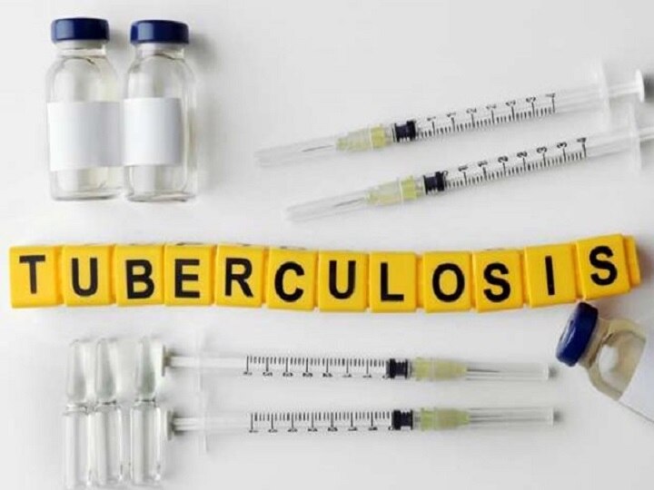 Tuberculosis Bacteria Trigger Cough, Facilitates Spread: Study Tuberculosis Bacteria Trigger Cough, Facilitates Spread: Study