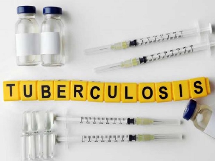 Tuberculosis Bacteria Trigger Cough, Facilitates Spread: Study