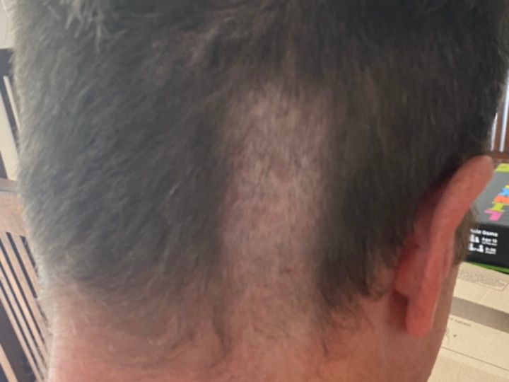 Ex-England Cricketer Robert Key Shares Picture Of Disastrous Haircut Ex-England Cricketer Robert Key Shares Picture Of Disastrous Haircut