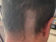 Ex-England Cricketer Robert Key Shares Picture Of Disastrous Haircut