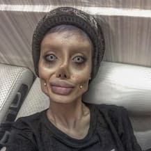 Instagram Star Sahar Tabar Aka ‘Zombie Angelina Jolie’ Put On Ventilator Due To Coronavirus