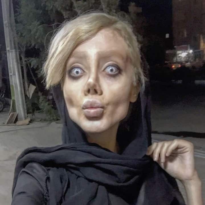 Instagram Star Sahar Tabar Aka Zombie Angelina Jolie Put On Ventilator