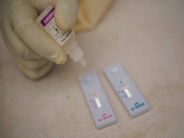 Coronavirus Tips, Corona treatment: Explained- COVID-19 Testing, Rapid Testing, Test Kits COVID-19 Testing Explained: How Is It Done & What Is Rapid Antibody Testing?