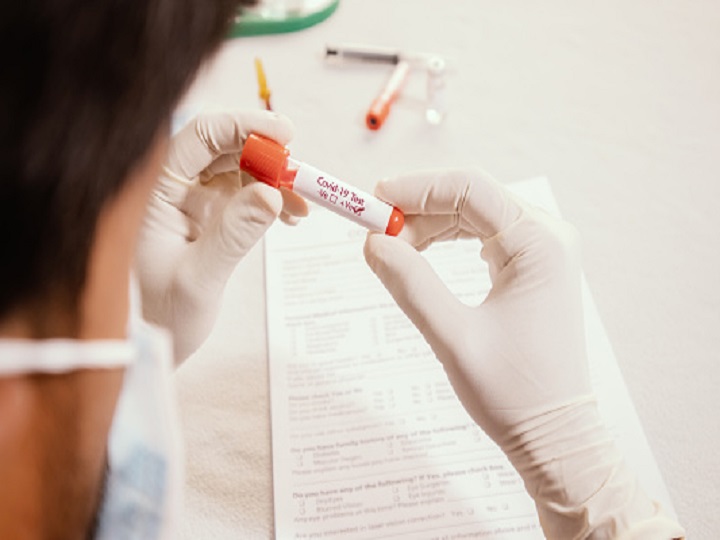 US Food And Drug Agency Authorises ‘At-Home Test’ Kits For Coronavirus FDA  Authorises ‘At-Home Test’ Kits For Coronavirus