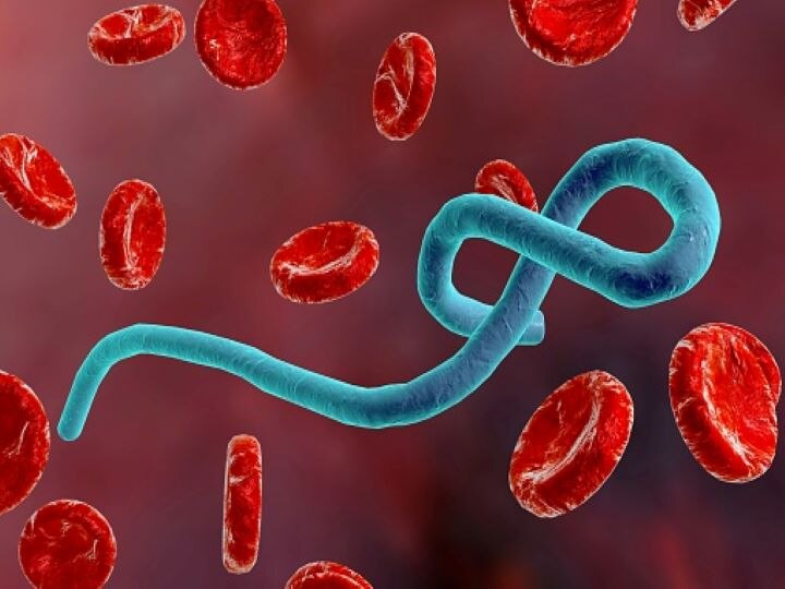 Ebola Virus Outbreak in Republic Of Congo Amid Covid-19 Crisis; Know What is It & Its Symptoms Ebola Virus Outbreak In Republic Of Congo Amid Covid-19 Crisis; Know What Is It & Its Symptoms
