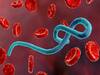 Ebola Virus Outbreak In Republic Of Congo Amid Covid-19 Crisis; Know What Is It & Its Symptoms