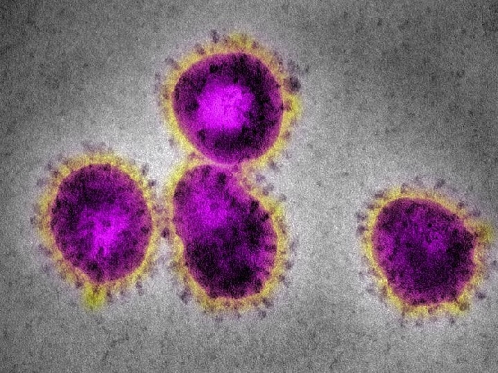 G4 EA H1N1: Novo vírus com potencial pandémico detetado na China
