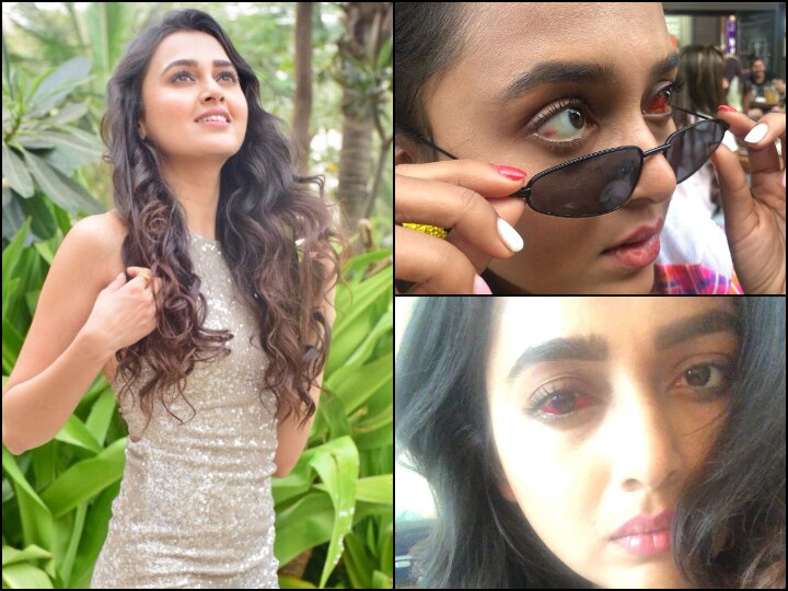 Khatron Ke Khiladi 10: Tejasswi Prakash Shares Glimpse Of Her Eye Injury, Asks Fans To 'Swipe At Own Risk' Khatron Ke Khiladi 10: Tejasswi Prakash Shares Glimpse Of Her Eye Injury, Asks Fans To 'Swipe At Own Risk'