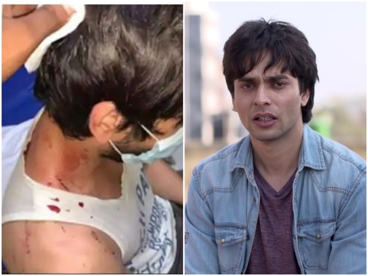 Dil Toh Happy Hai Ji TV Actor Ansh Bagri Beaten Up By 10 Men In Delhi; Suffers Head Injuries TV Actor Ansh Bagri Badly Beaten Up By 10 Men In Delhi; Suffers Head Injuries