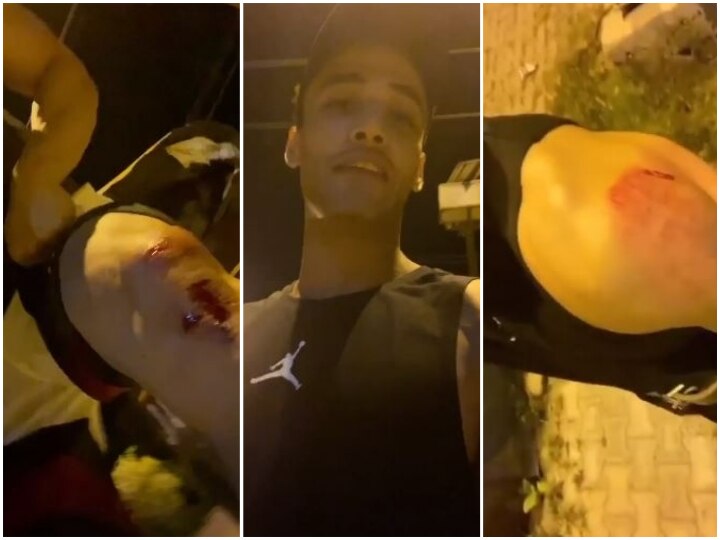 Bigg Boss 13’s Asim Riaz Brutally ATTACKED By Goons While He Was Out Cycling; Gets Multiple Bruises Bigg Boss 13’s Asim Riaz Brutally ATTACKED By Goons While He Was Out Cycling; Gets Multiple Bruises