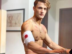 Bigg Boss 13's Asim Riaz Shares PICS Of Injured Arm & Multiple Bruises; Fans Send Wishes