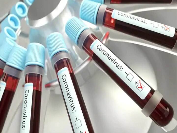 Five Hockey Players Tested Positive For Coronavirus Yesterday, Now Doing Well Five Hockey Players Tested Positive For Coronavirus Yesterday, Now Doing Well