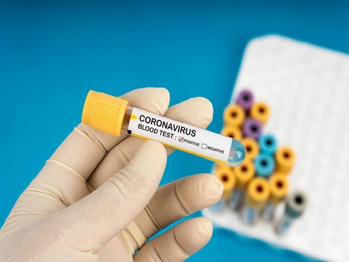 Coronavirus Covid-19: Health Ministry Recommends Tests For All Tuberculosis Patients Vice Versa Health Ministry Recommends Covid-19 Tests For All Tuberculosis Patients And Vice Versa