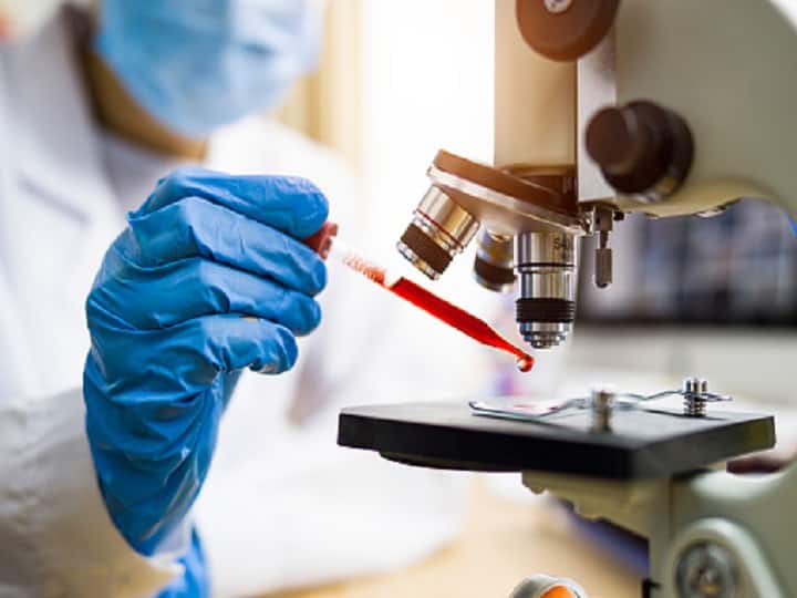 Now Threat Of Congo Fever In Maharashtra? Know What Is It & What Are Its Symptoms Now Threat Of Congo Fever In Maharashtra? Know What Is It & What Are Its Symptoms