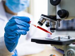 Chapare Virus: Another Deadly Virus On The Rise? Know All About The Ebola Like Virus In Bolivia