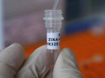 जीका संक्रमण से इन तंत्रिकाओं को भी हो सकता है नुकसान!